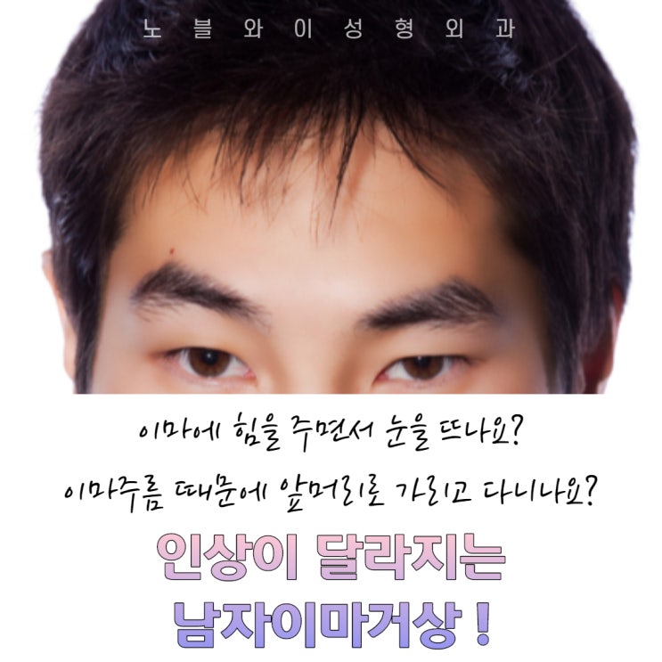  남자이마거상 인상도 달라져요