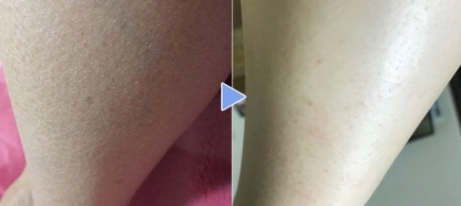 보습 바디로션으로 뱀 같았던 피부도 안녕! 5