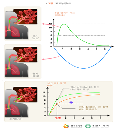 폐기능 검사(PFT) : 검사 방법, 결과, 해석, 비정상 유형