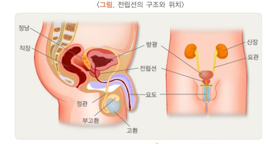  전립선 비대증
