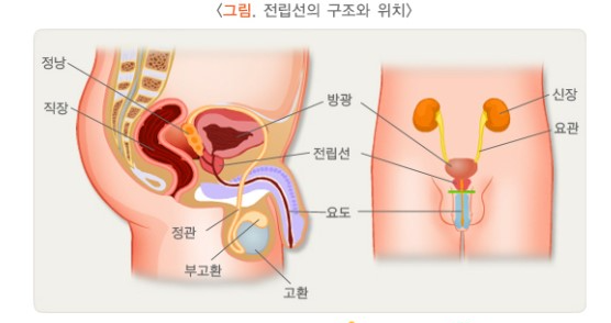 전립선 비대증