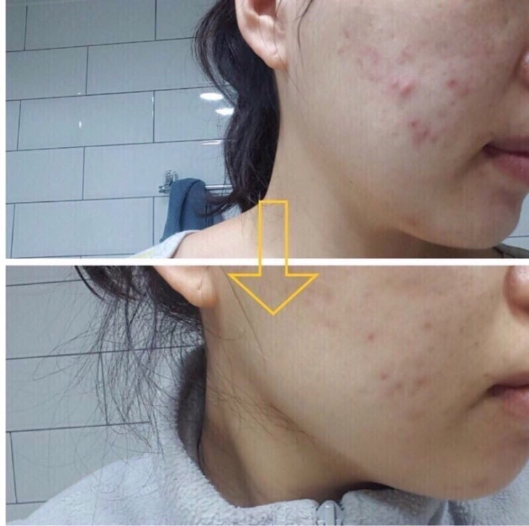  제리카 주문 폭주!!!!!!!!!! 선착순 마감 추가 선착순 증정 더 주신데요ㅠㅠ 기미 색소침착에 이만한 제품 없지요ㅠㅠㅠㅠㅠ 
