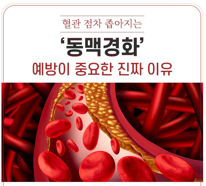  동맥경화와 식단 조절