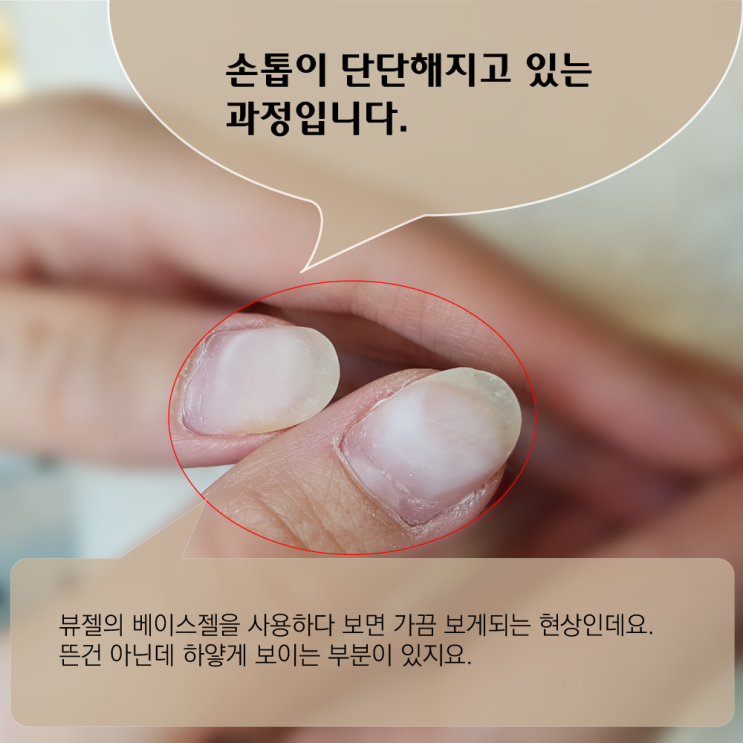  손톱이 건강해지는 과정