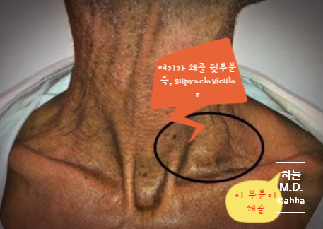  의학용어 Prefix(3)