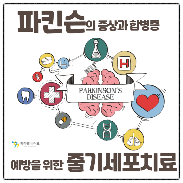  파킨슨의 증상과 합병증 예방, 줄기세포치료로 시작한다