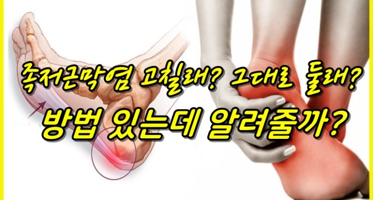 심한 발통증의 원인 족저근막염 잡는 기능성신발