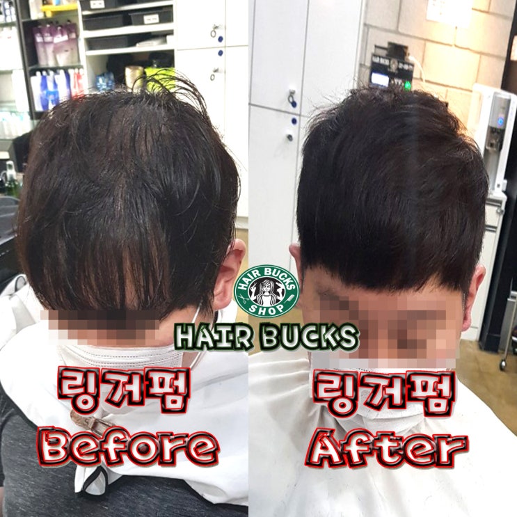  남자분들 모류교정 + 뿌리볼륨 = 링거펌 으로 자신감 UP !!!링거펌전문점 헤어벅스