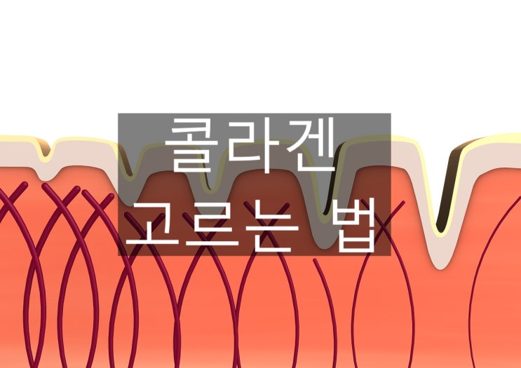  콜라겐 고르는 법