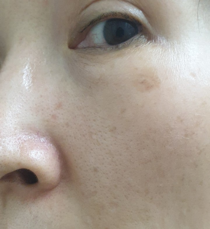 기미순치 크림이 얇아져요. 6