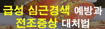  심근경색. 뇌졸중의 주요 원인;     심장·뇌혈관 막는 '혈전' 없애는 법 3가지 방법