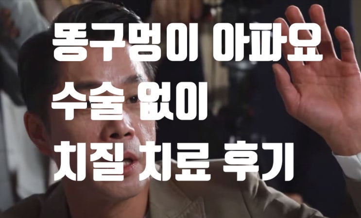 똥구멍이 아파요, 수술없이 치질 치료 후기