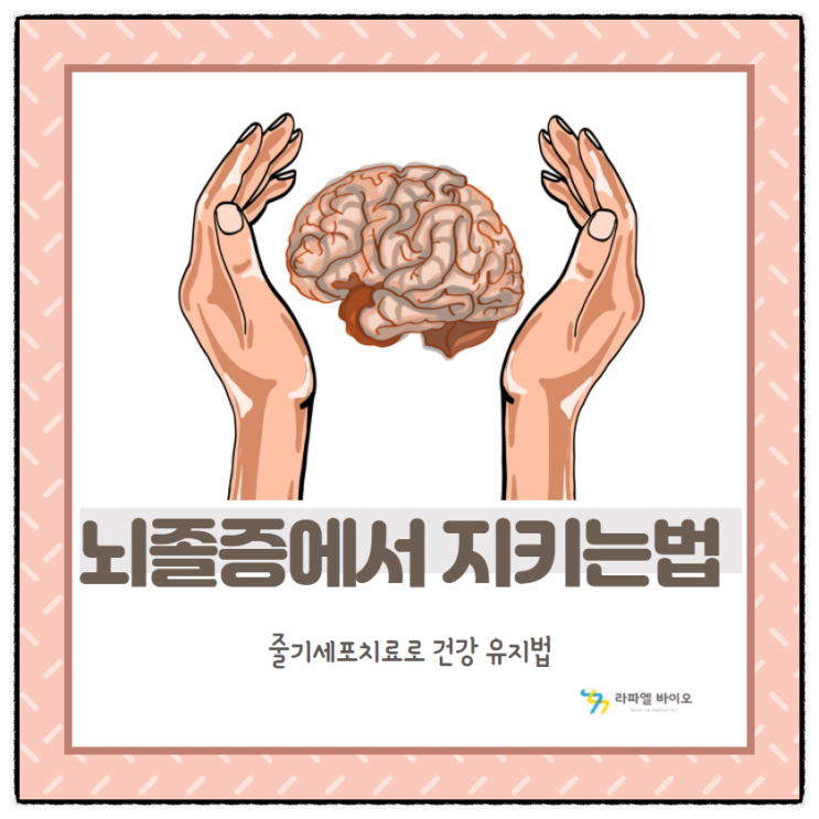  뇌졸중에서 지키는 방법! 줄기세포치료로 건강 유지 방법!