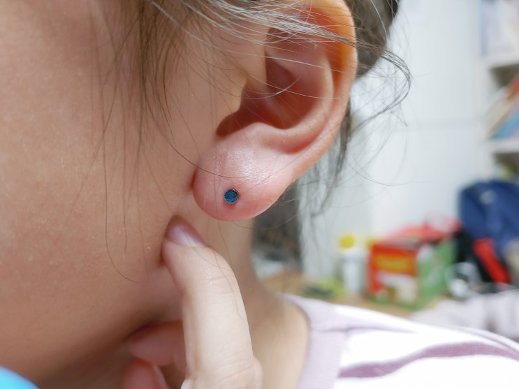 셀프 귀뚫기 팁 초등학생 써지컬스틸 귀걸이 + 소독 방법