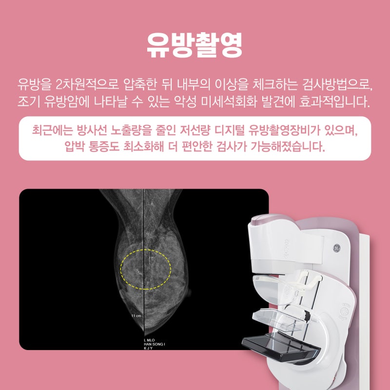 유방암 검사 방법(종류)은 왜 다양한가? 잘 알아둬야지. 2