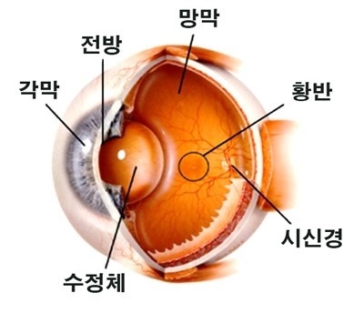 황반변성 치료 가능할까요?