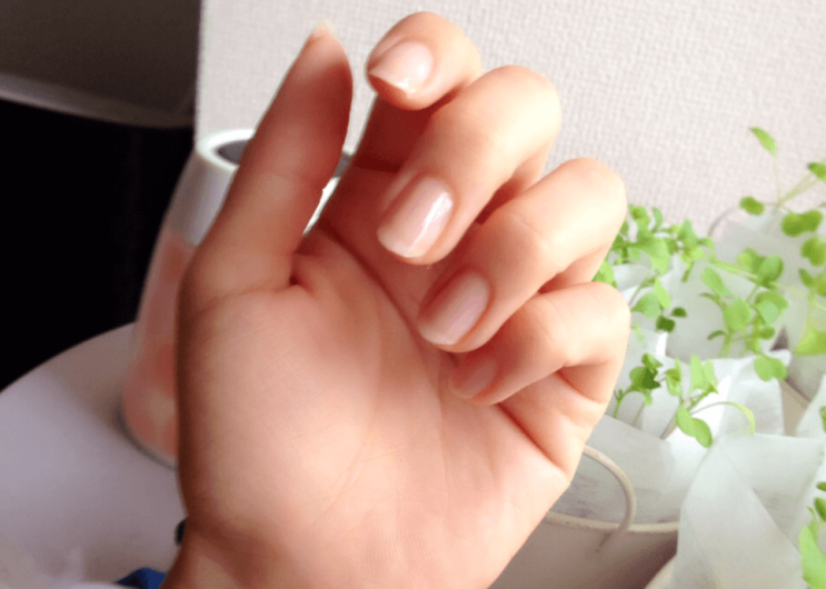  잠잘때 팔저림 심하다면