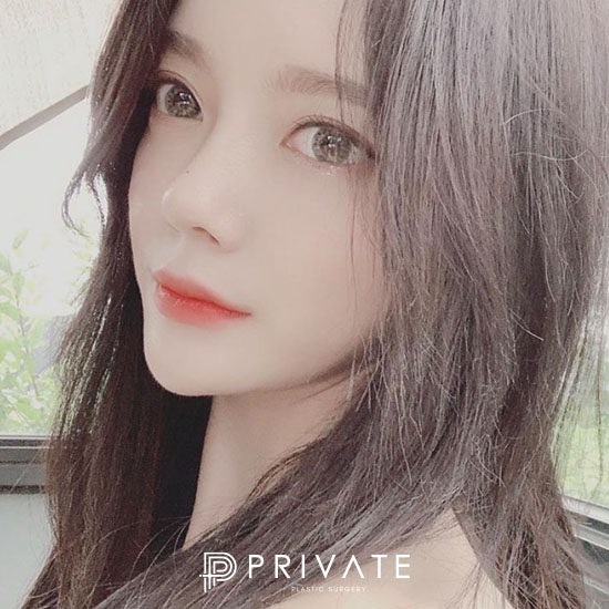 Operasi Plastik Mata dan Hidung di Sinsa Private Plastic Surgery 사진 2