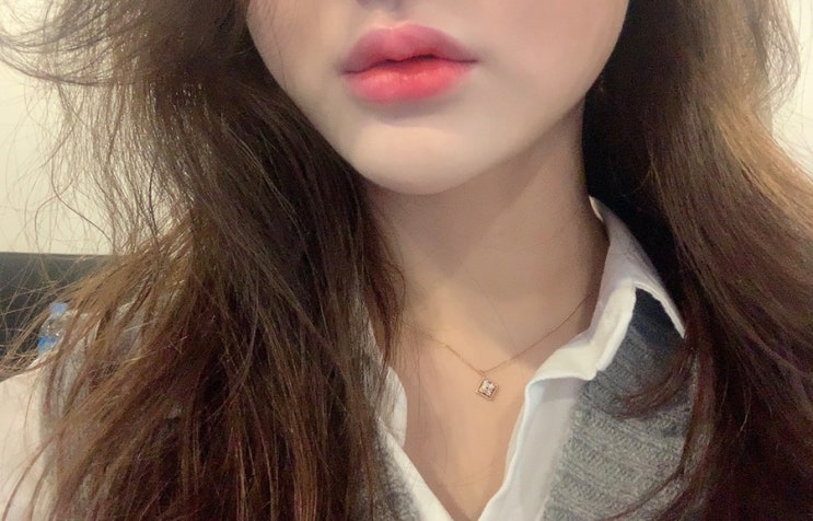  브잉라인 레인보우 스텝 솔루션 4회차 / 왕십리 피부과 윤곽주사 얼굴라인 정리 마지막 후기