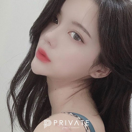 Operasi Plastik Mata dan Hidung di Sinsa Private Plastic Surgery 사진 8