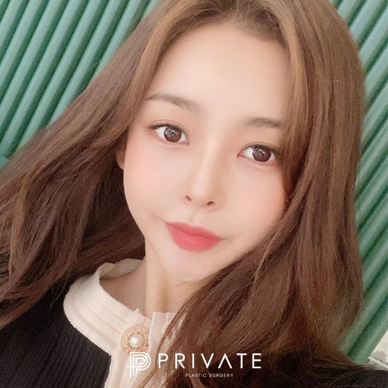 Operasi Plastik Mata dan Hidung di Sinsa Private Plastic Surgery 사진 3