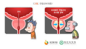 간호학 전립선비대증 원인증상 위험요인: 전립선자가진단 비뇨기장애치료 간호학 전립선비대증 원인증상 위험요인: 전립선자가진단 비뇨기장애치료
