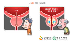 간호학 전립선비대증 원인증상 위험요인: 전립선자가진단 비뇨기장애치료