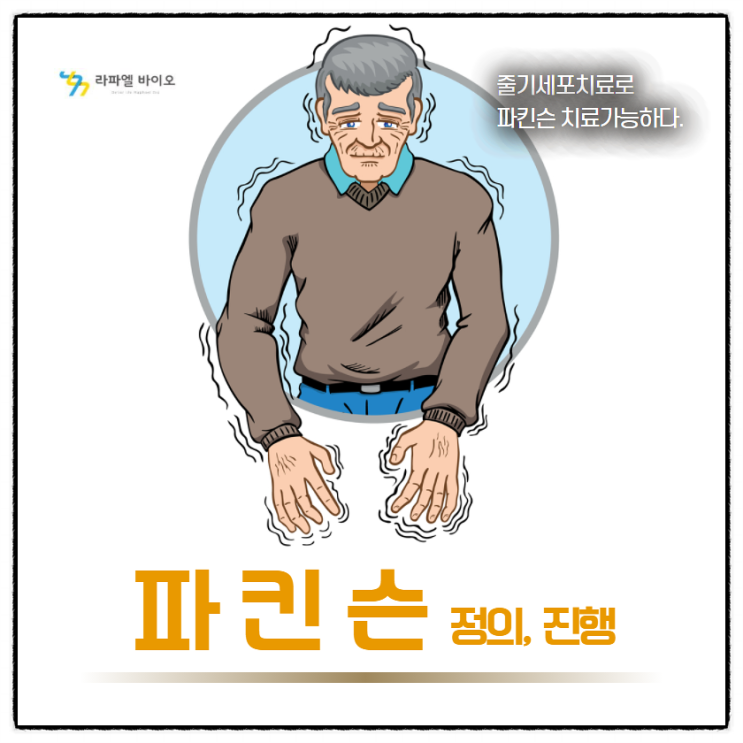  파킨슨 증상과 파킨슨병 줄기세포치료
