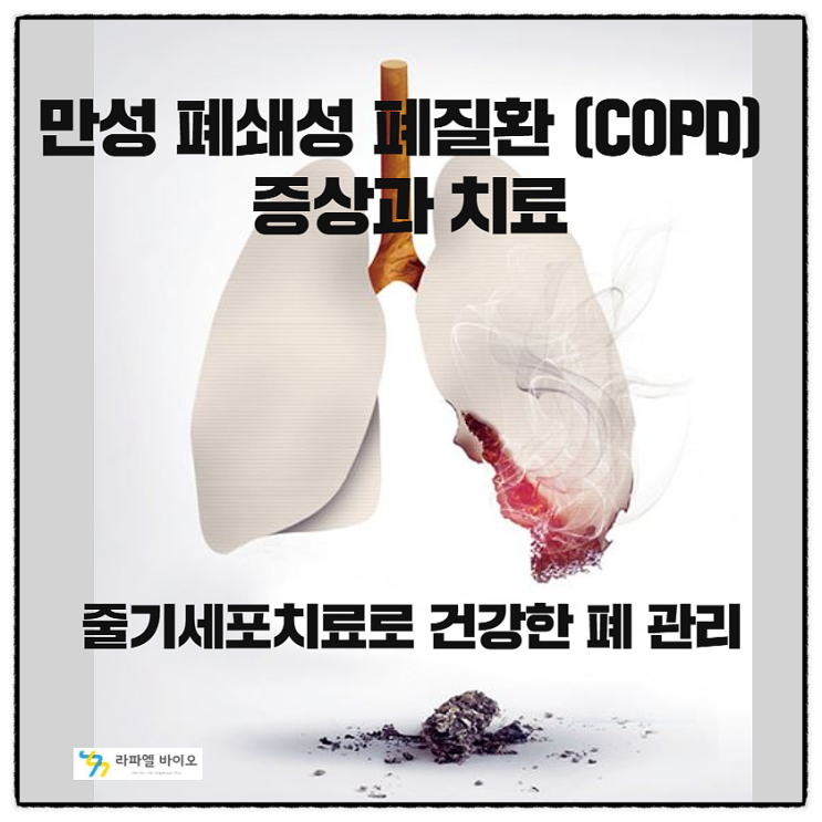 만성폐쇄성폐질환 (COPD) 고통, 줄기세포치료로 건강하게~