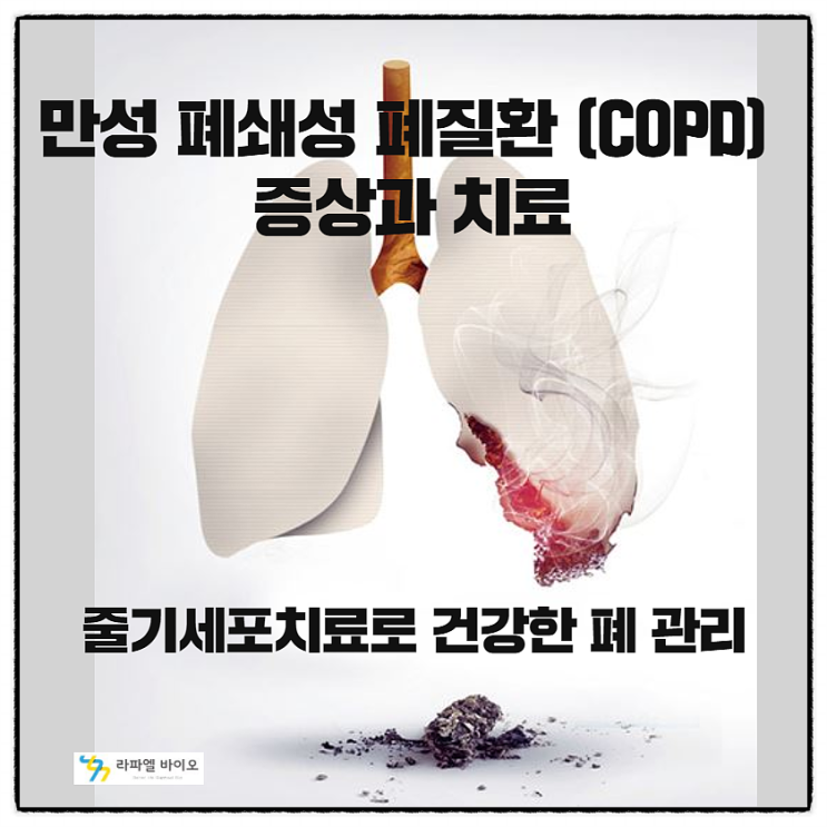  만성폐쇄성폐질환 (COPD) 고통, 줄기세포치료로 건강하게~