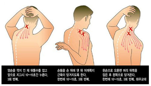  옷 태를 망치는 승모근!                 줄일 수 있는 방법을 알아봅시다!