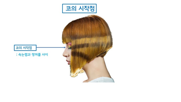  짧은 코 교정의 또 다른 원인은 미간 콧대