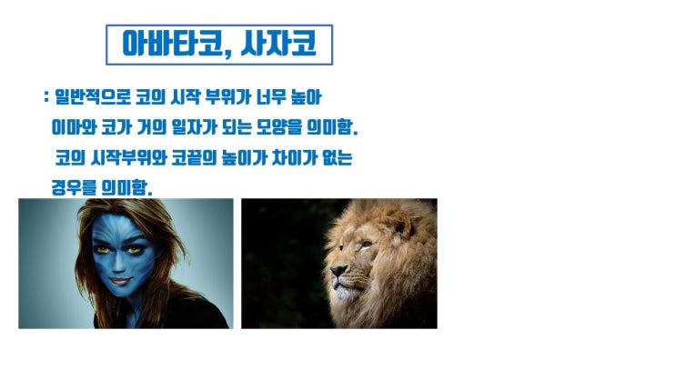  아바타코 절대로 안 되는 미간콧대 코성형
