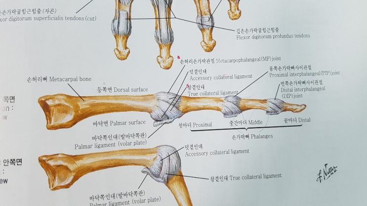  인천 가좌동 손가락 통증 한의원 3번째 이야기