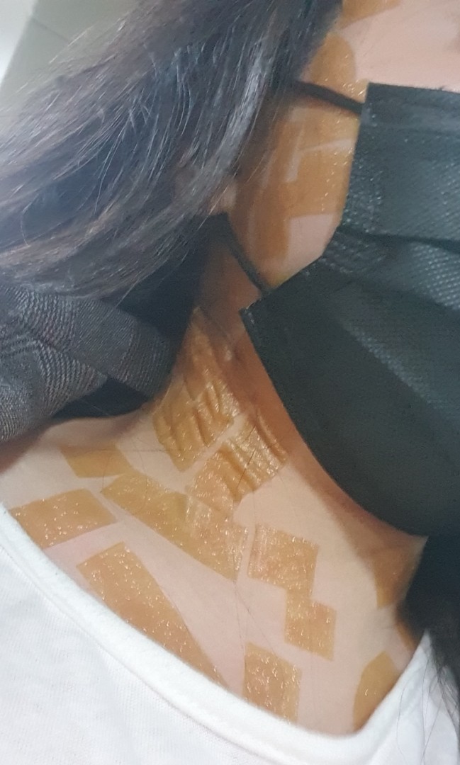  박멸해버리고 싶은.. 편평사마귀 제거 후기 가져왔어요!ㅎㅎ