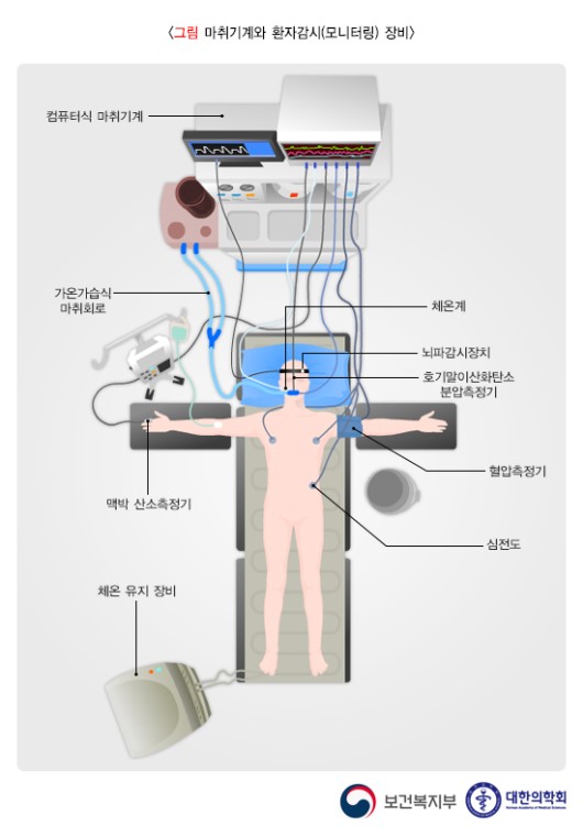  수면마취 전신마취 차이 무엇인가요?