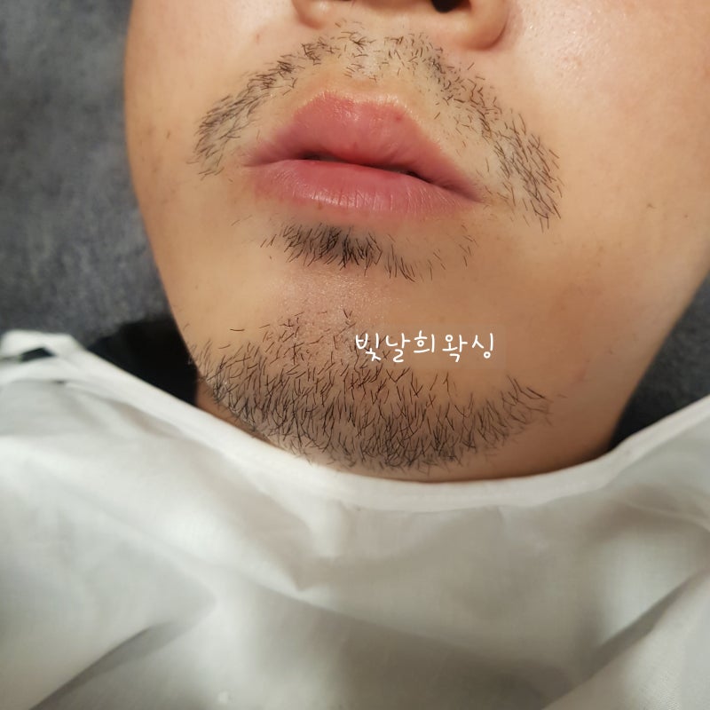 양산왁싱 잘하는곳 남자수염왁싱가격도싸고 빛나는히왁싱 2