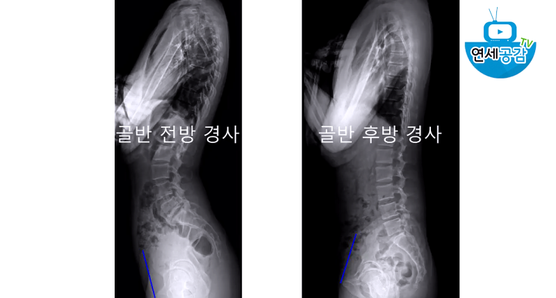창원시 상남동 필라테스의 일그러진 골반을 바르게 교정하다 11