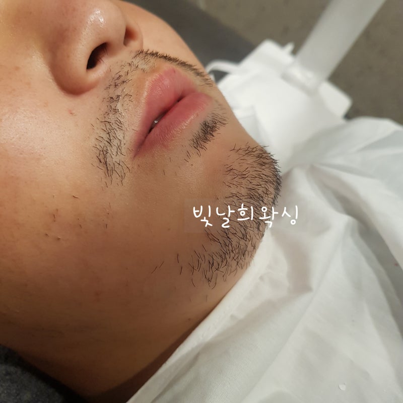 양산왁싱 잘하는곳 남자수염왁싱가격도싸고 빛나는히왁싱 3
