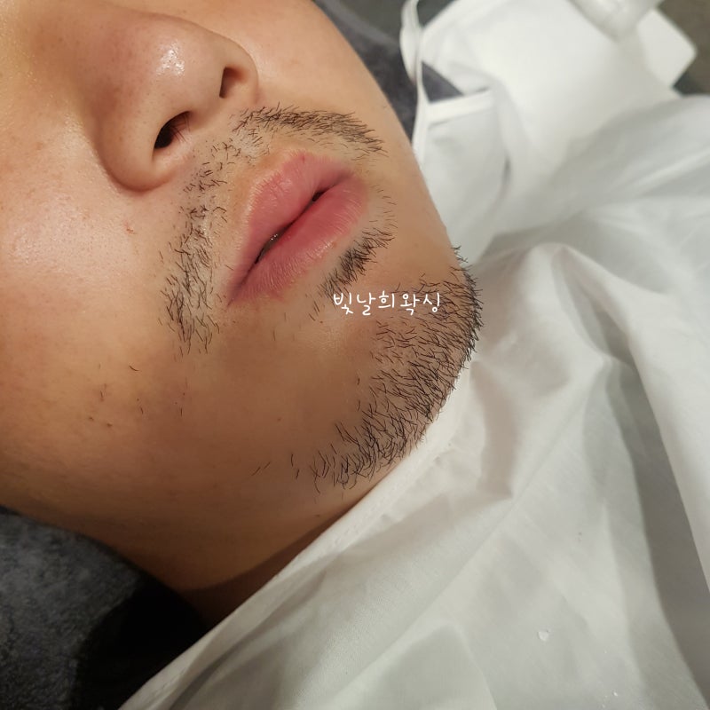 양산왁싱 잘하는곳 남자수염왁싱가격도싸고 빛나는히왁싱 1