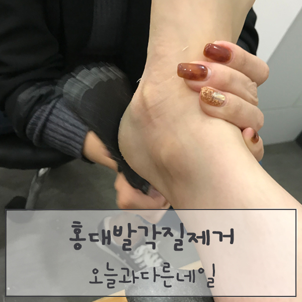  홍대 발각질제거 "오늘과다른네일" - 속이 뻥 뚫리는 완벽 케어!