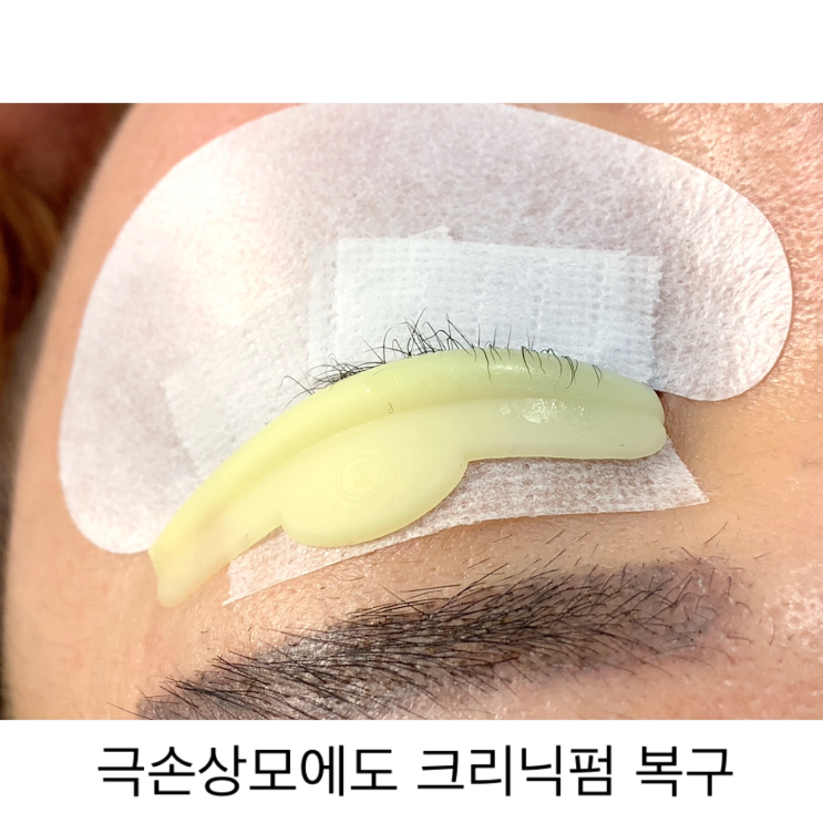  극손상모도 '크리닉펌' 으로 완전 복구!