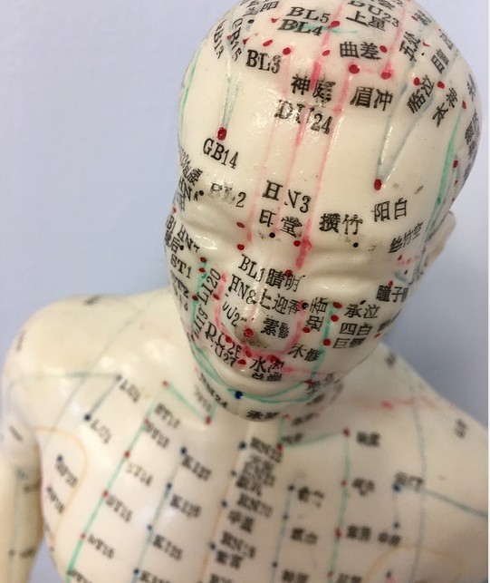 침술원에서 침술 치료 받는 이유는? 침술원에서 침술 치료 받는 이유는?