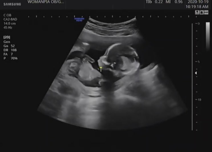 임신 16-18주 차 성별, 체끼, 자궁배 콕콕, 일상블로그, 엄마가 되기란