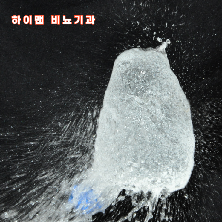  잔뇨량 검사 방법과 의미