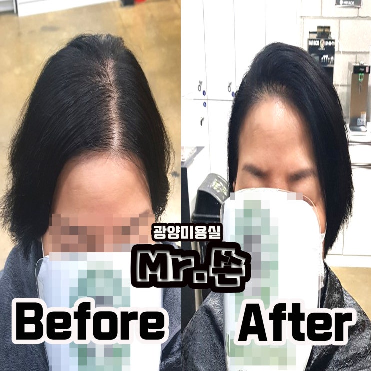  60대 고객님께서 링거펌으로 회춘하셨습니다 !!