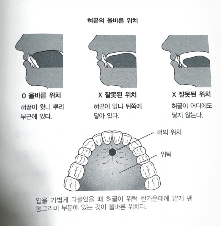  [건강] 뇌 노화(치매)와 치아관리