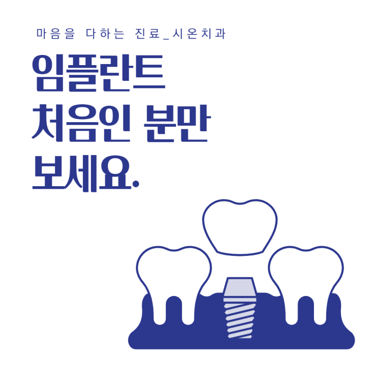  괴정치과추천? 임플란트 처음인 분만 보세요.