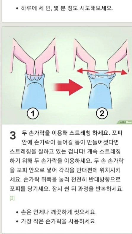 가성포경을 자연포경 만들기 : 네이버 블로그 가성포경을 자연포경 만들기 : 네이버 블로그