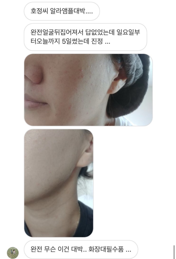  웨딩팩  ccc / 결혼하기전 찾을정도로 눈에띄는 효과!!!!!